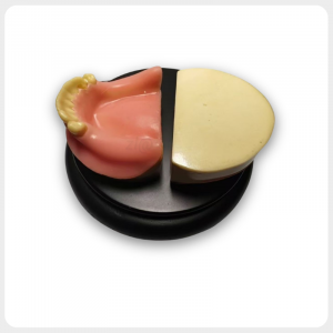 upper jaw dental implant model with partial teeth