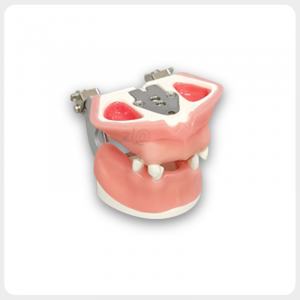 Implant Practice Dental Model with Inner Maxillary Structure Dental Jaw Model Showing Implant Base and Gingival Tissue
