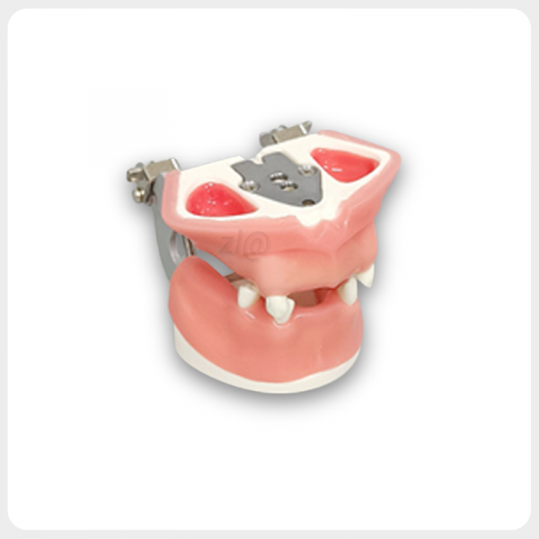 Implant Practice Dental Model with Inner Maxillary Structure Dental Jaw Model Showing Implant Base and Gingival Tissue