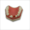 Top view of maxillary dental implant training model with missing tooth socket
