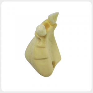 Dental Implant Training Model - Occlusal View Top view of maxillary partial edentulous model showing alveolar ridge width and implant