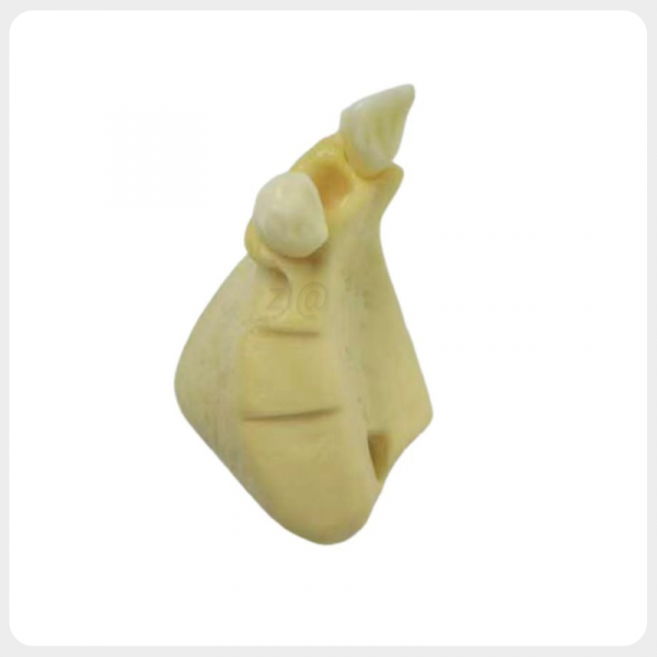 Dental Implant Training Model - Occlusal View Top view of maxillary partial edentulous model showing alveolar ridge width and implant