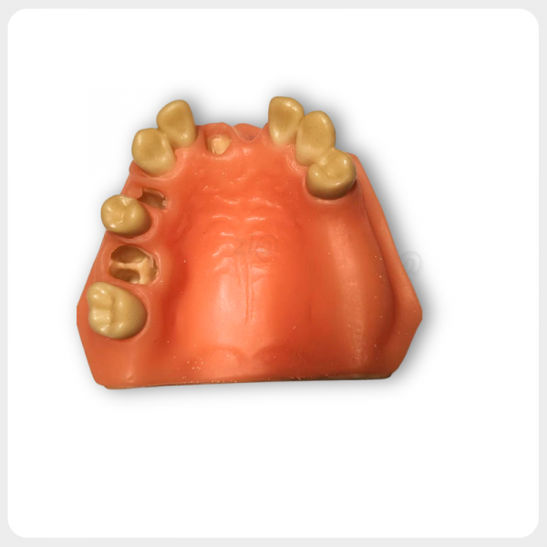 Upper jaw dental model with soft gingiva and clear implant preparation sites for training purposes