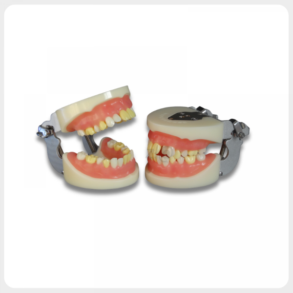 Dental tooth extraction training model with removable teeth and soft gum