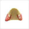 Dental Wisdom Tooth Surgery Practice Model dental oral surgery training model with simulated impacted wisdom tooth
