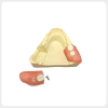 Replaceable Gum Block Dental Training Model replaceable gum block dental model for wisdom tooth extraction training