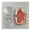 Dental Extraction Training Model with Removable Teeth Dental tooth extraction training model with removable teeth and roots
