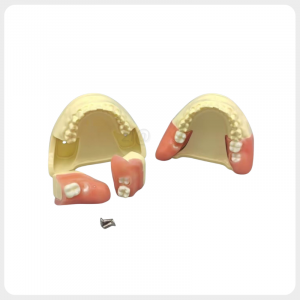 dental impacted wisdom tooth extraction training model with replaceable surgical blocks