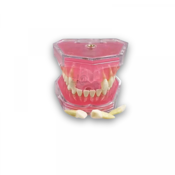 Dental Extraction Practice Typodont Dental extraction training model with removable tooth roots