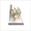 Side View Knee Joint Model Osteoarthritis Stages side view of knee joint model showing osteoarthritis stages for medical training