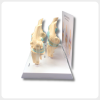 Rear View Knee Joint Model for Osteoarthritis Demonstration rear view knee joint model osteoarthritis progression for medical education