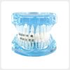 Orthodontic Bracket Comparison Dental Model Front View 4-in-1 orthodontic bracket comparison dental model front view blue transparent base
