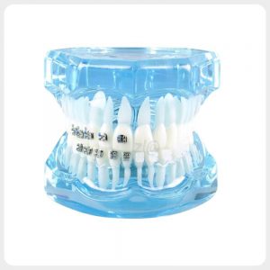 4-in-1 orthodontic bracket comparison dental model front view blue transparent base