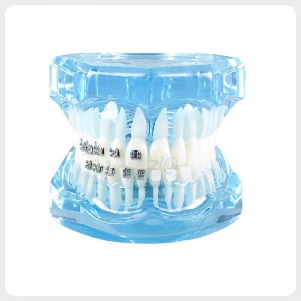 Orthodontic Bracket Comparison Dental Model Front View 4-in-1 orthodontic bracket comparison dental model front view blue transparent base