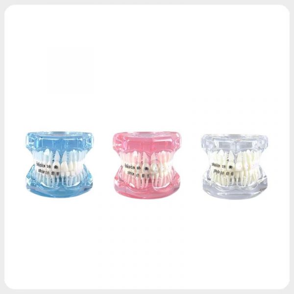 Orthodontic Dental Model in Multiple Color Options orthodontic dental model multiple colors bracket comparison teaching model