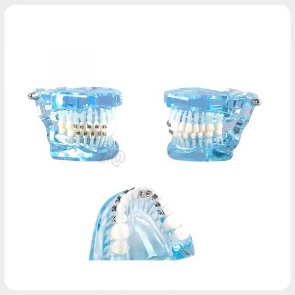 Side View Orthodontic Dental Training Model orthodontic dental model side view bracket alignment training model