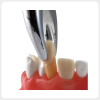 Removable tooth extraction demonstration dental training model