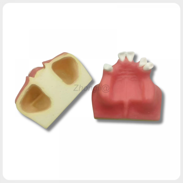 Upper Jaw Sinus Lift Dental Implant Training Model Structure upper jaw sinus lift dental implant training model with removable structure and built-in sinus cavity
