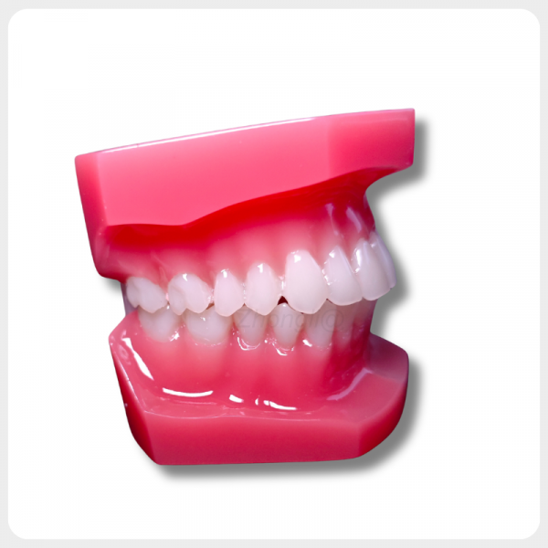 Side View Dental Orthodontic Model for Occlusion Demonstration Side view of upgraded dental orthodontic model showing clear occlusion