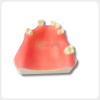 Upper Jaw Dental Implant Training Model Multiple Teeth upper jaw dental implant model multiple missing teeth for implant training practice