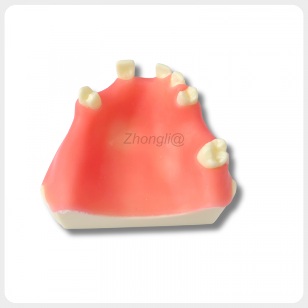 Upper Jaw Dental Implant Training Model Multiple Teeth upper jaw dental implant model multiple missing teeth for implant training practice