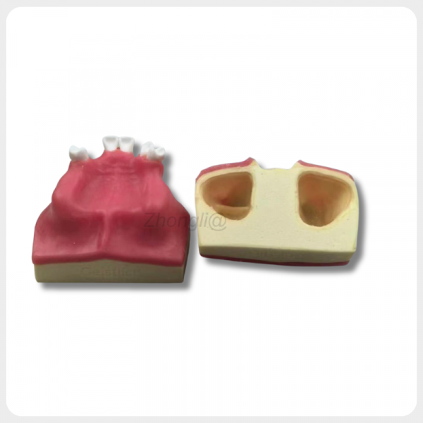 Dental Sinus Lift Training Model with Soft Gum Structure upper jaw dental sinus lift model with soft gum and D3 bone simulation for implant training