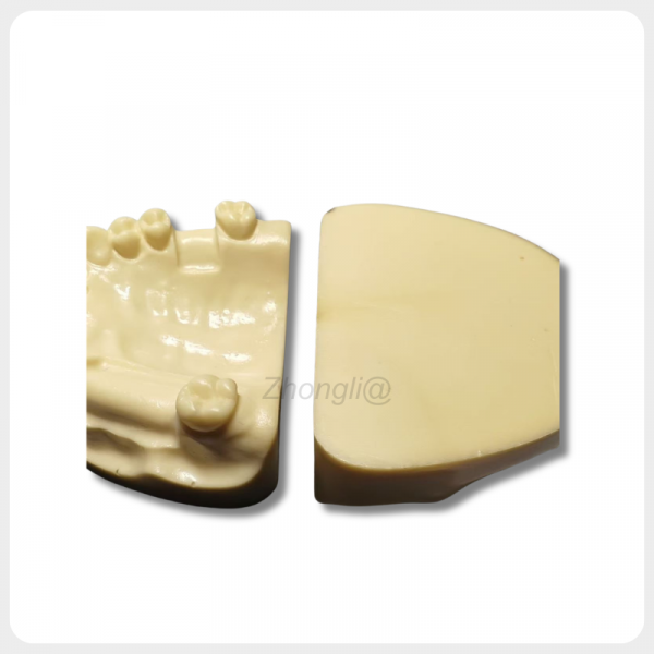 Sectional Dental Implant Model with Removable Block Design sectional dental implant model upper jaw removable block implant training model
