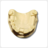 Top View Upper Jaw Implant Training Model for Placement Practice top view dental implant training model upper jaw multiple missing teeth implant placement practice