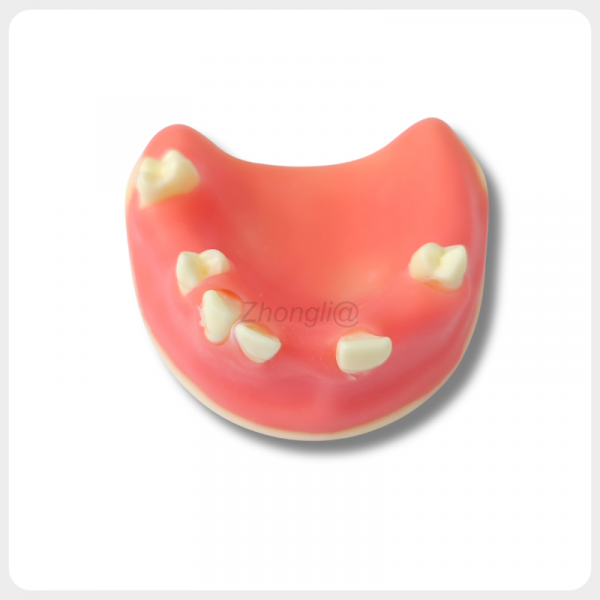 Dental Implant Practice Model for Implant Placement Training dental implant practice model upper jaw for implant placement and suturing training
