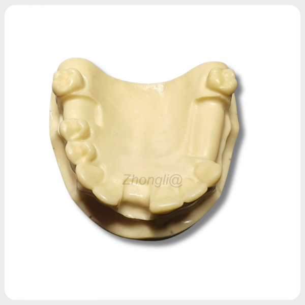 Top View Upper Jaw Implant Training Model for Placement Practice top view dental implant training model upper jaw multiple missing teeth implant placement practice
