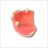 Dental Implant Model with Silicone Soft Tissue Gingiva implant training model with silicone soft tissue realistic gingiva dental model