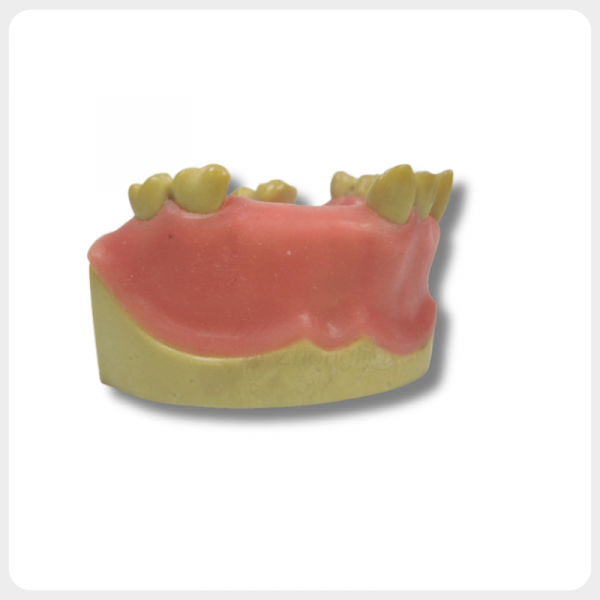 Dental Implant Model Side View with Gum and Bone upper jaw implant simulation model occlusal view