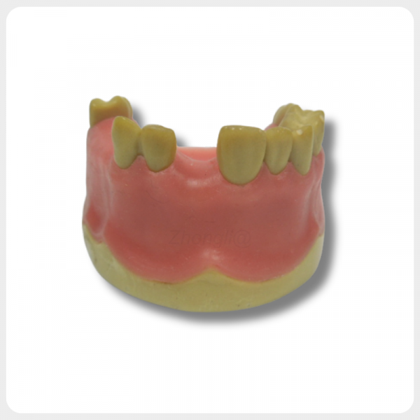 Dental Implant Practice Model Front View missing teeth dental implant practice model front view