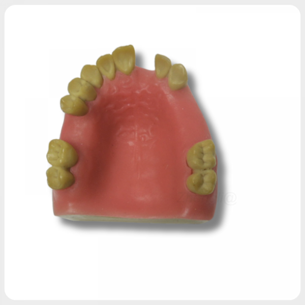 Upper Jaw Implant Model Top View dental implant training model side view gum bone