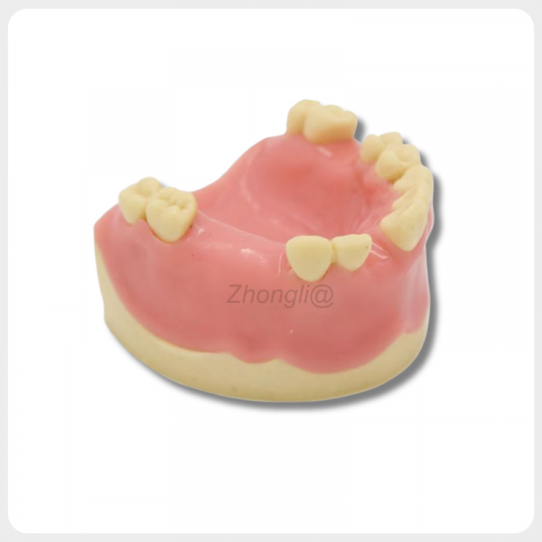 Upper Jaw Implant Training Model for Dental Practice upper jaw dental implant training model missing teeth