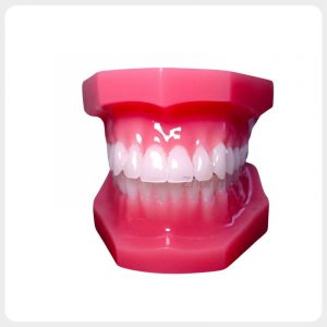 Upgraded dental orthodontic demonstration model front view with bright translucent teeth