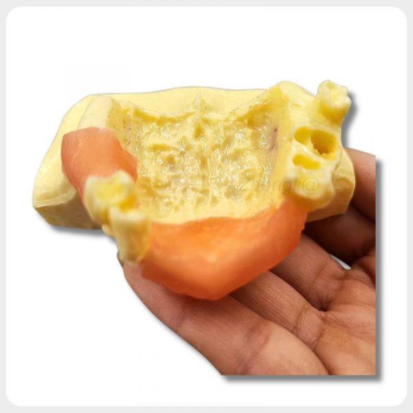 Maxillary Bone Defect Dental Implant Training Model Maxillary bone defect dental implant training model with soft tissue