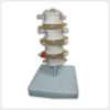4-section lumbar spine model with nerves and herniated disc