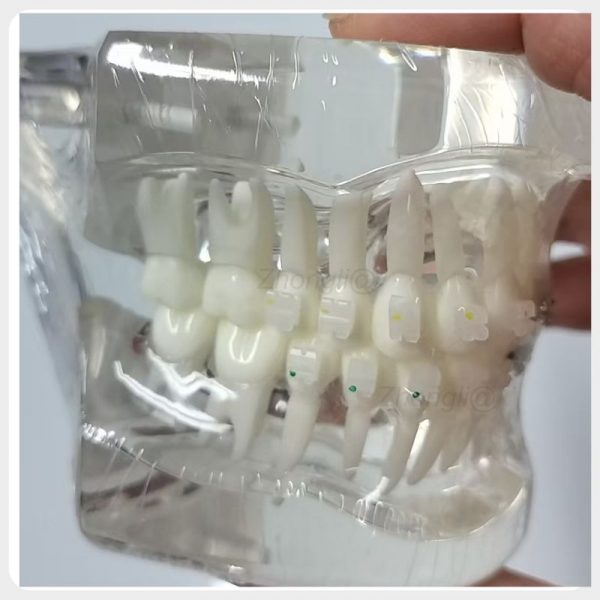 Unligated orthodontic training model with ceramic brackets and transparent dental arch for dental teaching