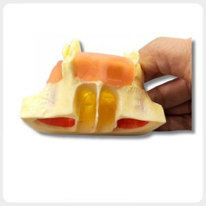 Dental implant training model with bone defect simulation