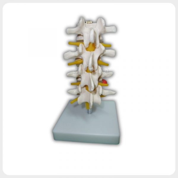 Side view of lumbar spine model with nerve branches