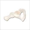 Human hip bone model showing acetabulum and obturator foramen