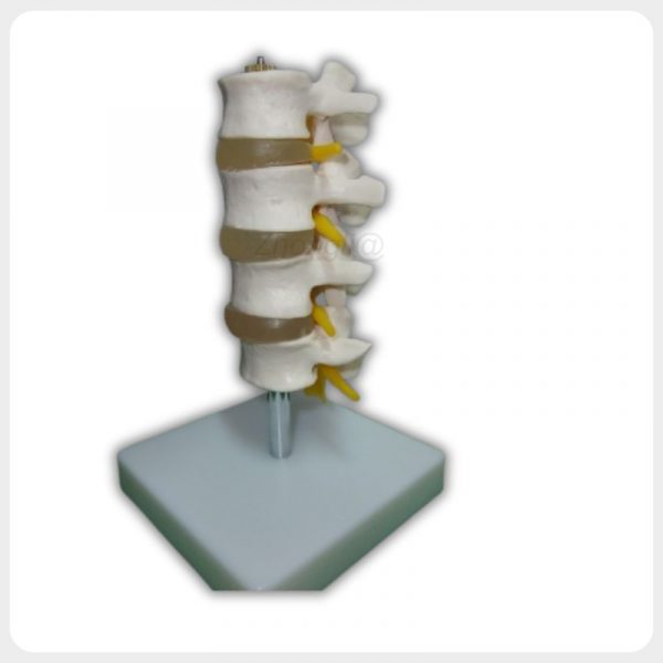Back view of lumbar spine anatomy model with stable base