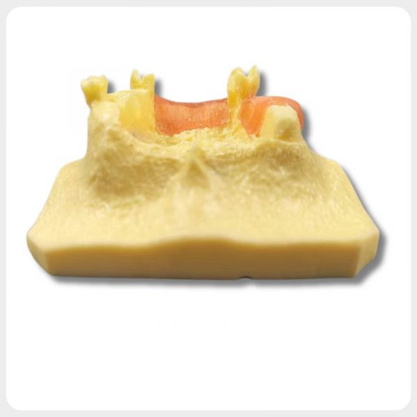 Dental Soft Tissue Implant Training Model Dental soft tissue model for implant case demonstration
