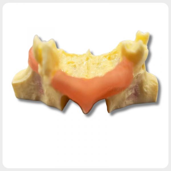 Dental Pathology Teaching Model Dental pathology teaching model with simulated bone defect