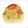 Maxillary Implant Case Training Model Maxillary implant case training model for dental education