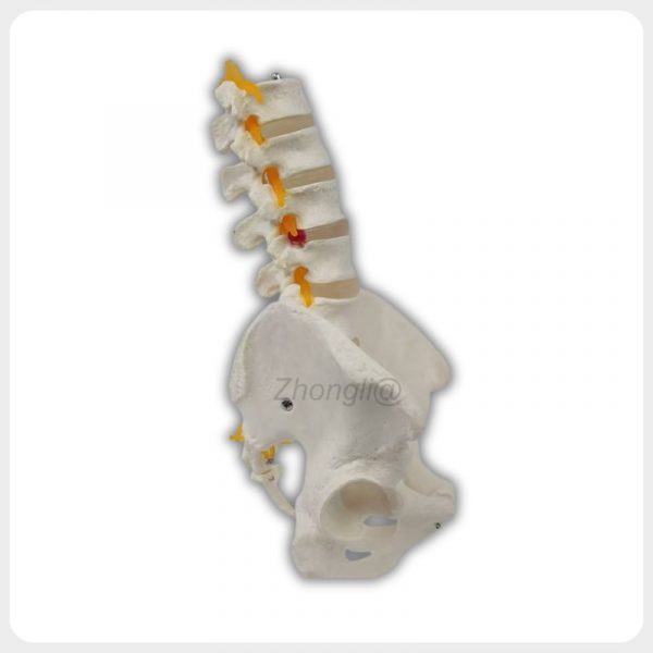 Side view of lumbar spine model with pelvis and nerves