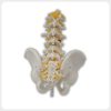 Back view of lumbar spine and pelvis model with nerves