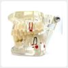 Transparent Periodontal Dental Demonstration Model Transparent periodontal and implant dental teaching model with visible lesions