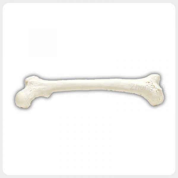 Distal Femoral Condyle Surface Teaching Anatomy Model Lateral view human femur showing distal femoral condyles shaft texture and proximal head for anatomy training